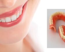 دندان مصنوعي منطقه 4