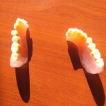 لابراتوار دندانسازی ساخت و تعمیر دندان مصنوعی بیلیچینگ نایت گارد فوری