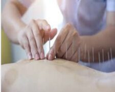 آموزش تکمیلی طب سوزنی