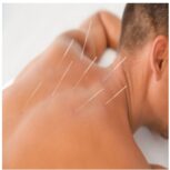 آموزش تکمیلی طب سوزنی