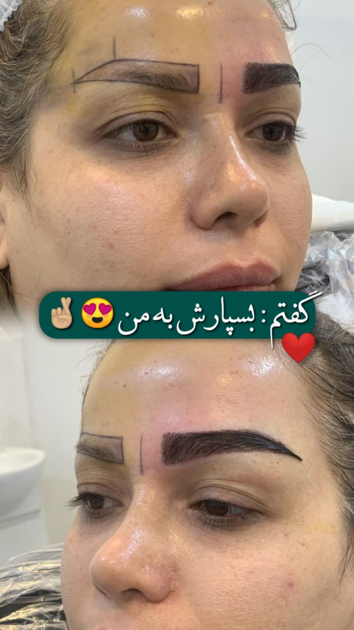کاشت ابرو جدید